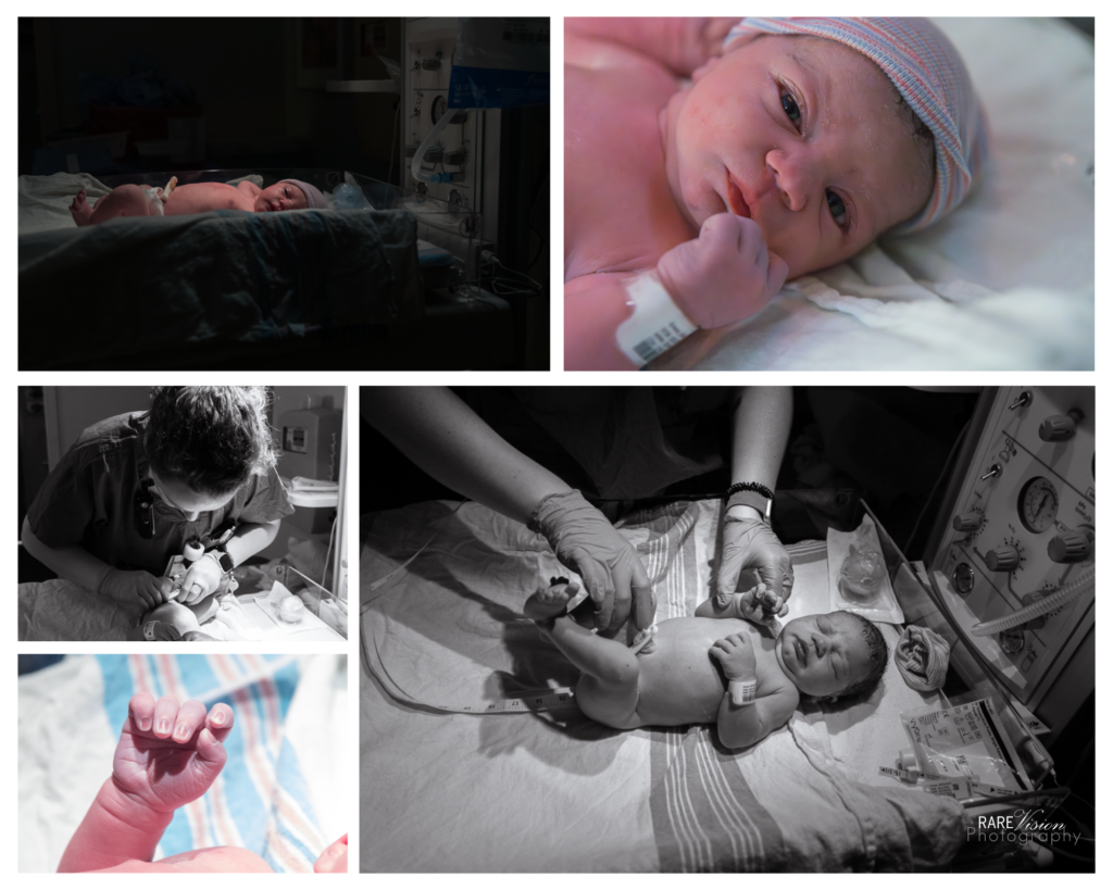 Images of baby after birth